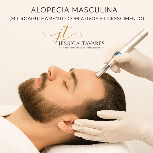 Protocolo Tricológico Masculino: Alta Performance Anti-Calvície (5 Sessões)
