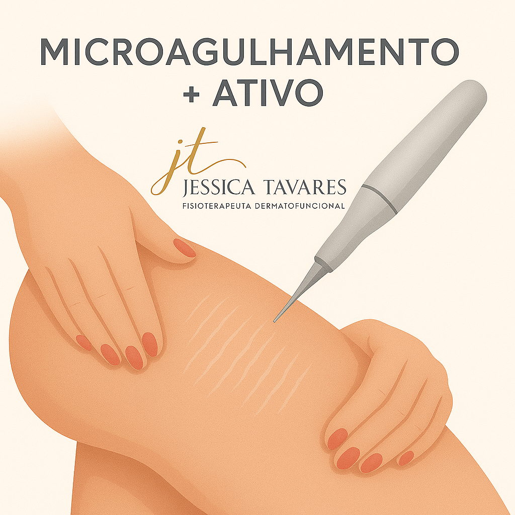 Microagulhamento Regenerador & Ativos