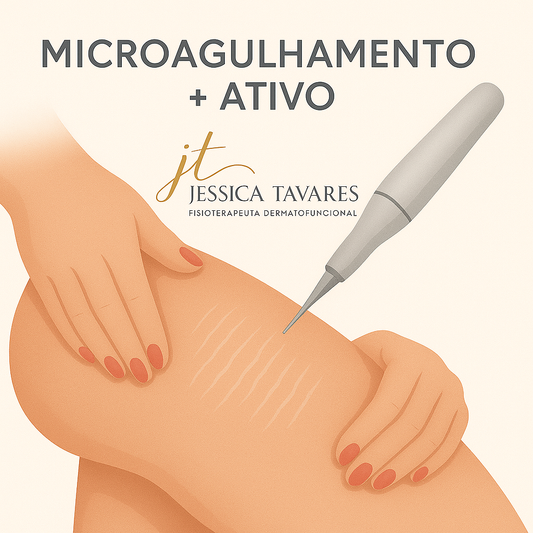 MICROAGULHAMENTO + ATIVO